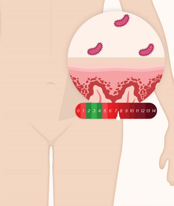 Feature product image