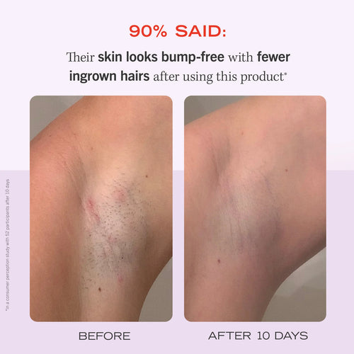 Brightest Bikini Line Serum