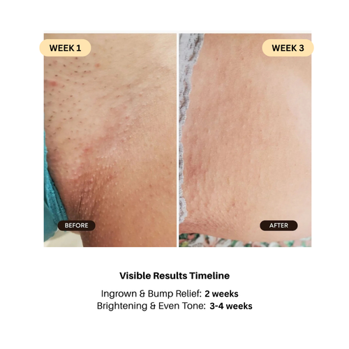 Brightest Bikini Line Serum