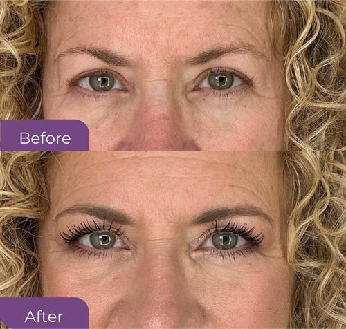 Magnetic Eyelash Kit™